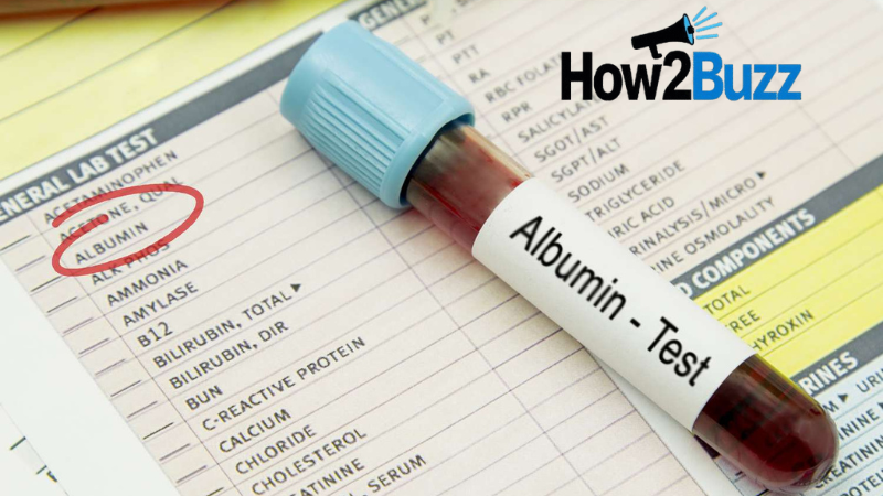 What is Albumīns and Why It Matters What is Albumīns and Why It Matters