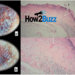 bpc 157 side effects