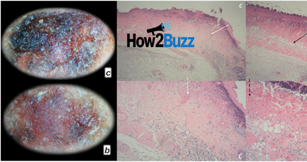 bpc 157 side effects
